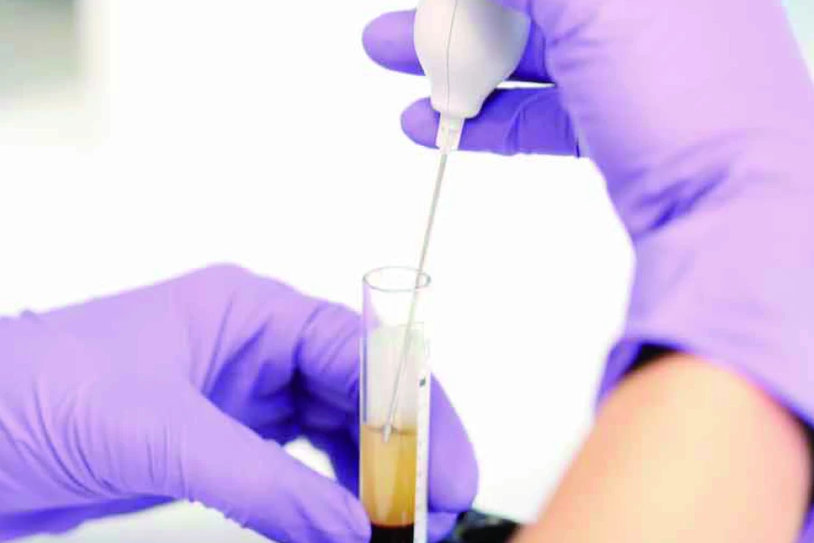 術後の合併症リスクを減少