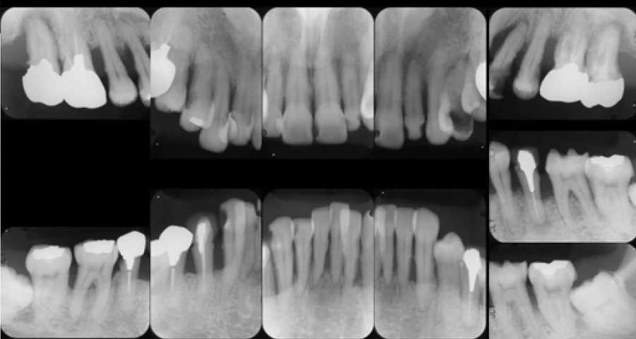 初診時と30か月後１